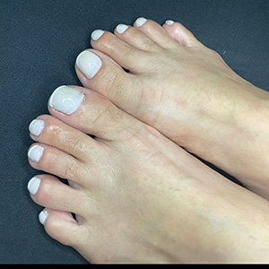 Pedicure em francesinha branca